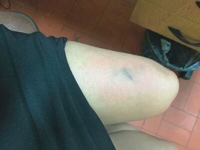 /pf/resources/images/abc-placeholder.png?d=2394