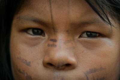 /pf/resources/images/abc-placeholder.png?d=2429