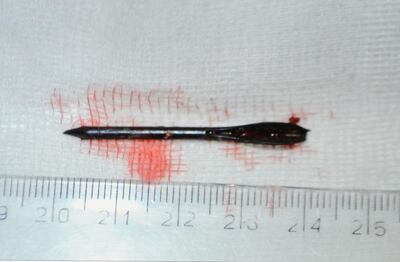 /pf/resources/images/abc-placeholder.png?d=2394