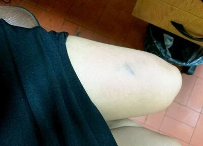 /pf/resources/images/abc-placeholder.png?d=2393