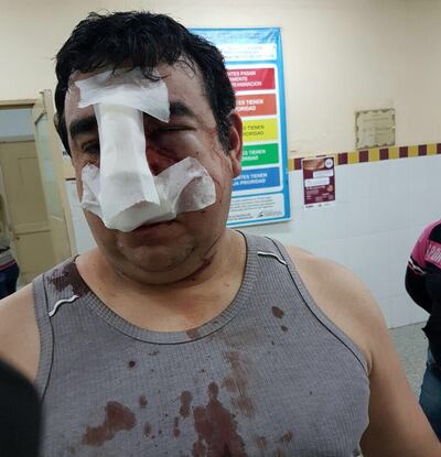 /pf/resources/images/abc-placeholder.png?d=2394