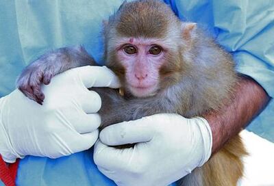 /pf/resources/images/abc-placeholder.png?d=2421