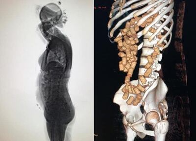 /pf/resources/images/abc-placeholder.png?d=2424