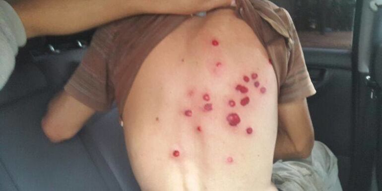 /pf/resources/images/abc-placeholder.png?d=2393