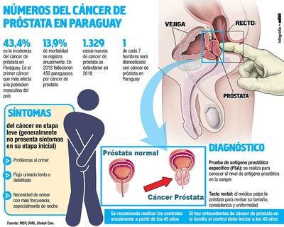 NÚMEROS DEL CÁNCER DE PRÓSTATA EN PARAGUAY