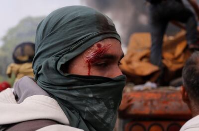 /pf/resources/images/abc-placeholder.png?d=2394