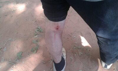 /pf/resources/images/abc-placeholder.png?d=2394