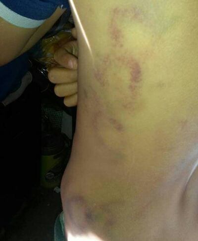 /pf/resources/images/abc-placeholder.png?d=2393