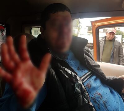 El agredido terminó con el rostro, las manos y el abrigo con cantidad de sangre, fruto de la herida.