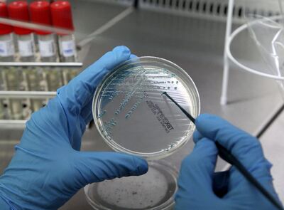 El tratamiento de bacterias de Eschericia coli para que procesen CO2, en etapa experimental, tiene potencial.