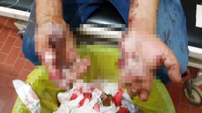 /pf/resources/images/abc-placeholder.png?d=2394