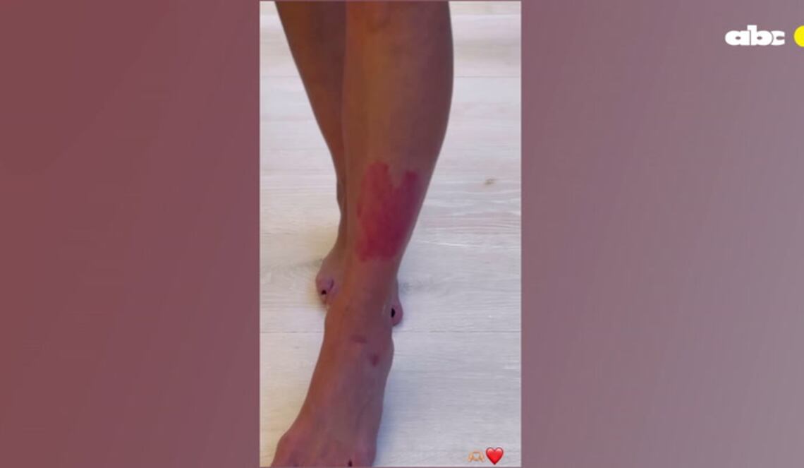 Background ABCTV JWP