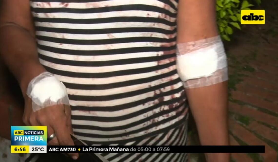 Background ABCTV JWP