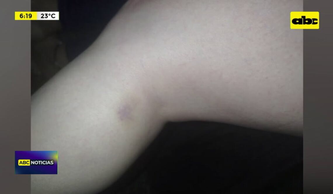 Background ABCTV JWP