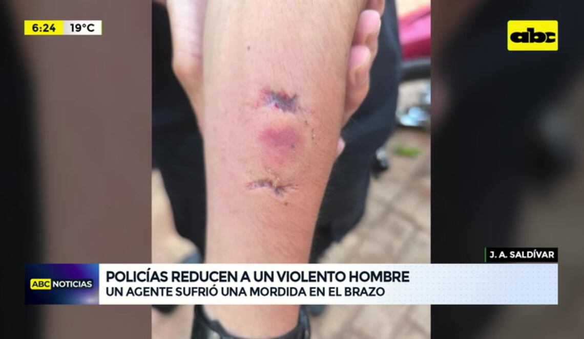 Background ABCTV JWP