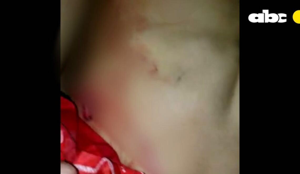 Background ABCTV JWP