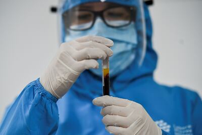 Muestras de sangre para analizar la presencia de coronavirus en el laboratorio.