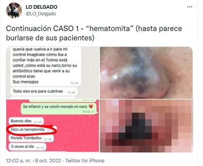Nuevos testimonios de presunta negligencia médica cometida por el doctor Carlos Alfieri salieron a luz el fin de semana.