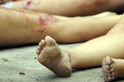 /pf/resources/images/abc-placeholder.png?d=2394