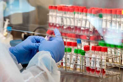 Investigación a gran escala sobre tiempo de inmunidad de recuperados de covid ofrece resultados alentadores.