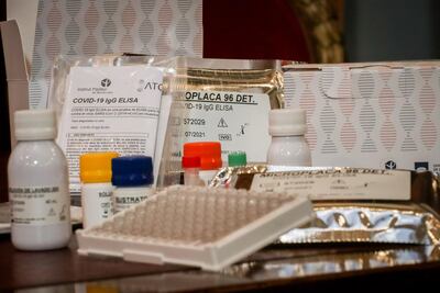 Los kits de exámenes serológicos  que los científicos uruguayos lograron desarrollar y producir.