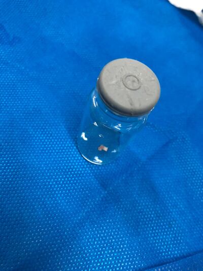 El objeto extraño que fue extraído del pulmón del niño.