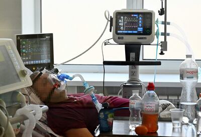 Un paciente con Covid, permanece intubado en una unidad de terapia intensiva en un hospital de Kiev, Ucrania.