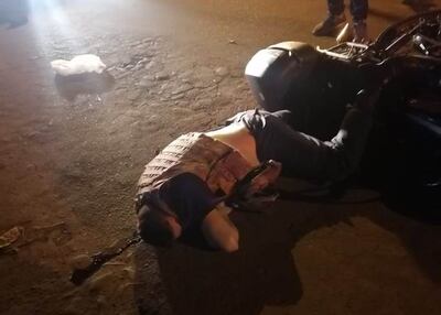 El motociclista sufrió lesiones graves en varias partes del cuerpo.