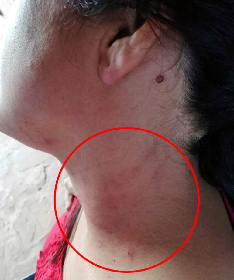 Gentileza. Una de las lesiones fue en el cuello.