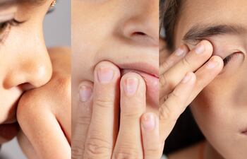 Se desconocen condicionantes que expliquen por qué afecta a personas de distintas edades, sexo, o con enfermedades preexistentes. Numerosos mitos rodean a su aparición: estrés, tensión nerviosa, soplo de viento y tantos otros pero ninguno tiene evidencia médica que lo pruebe.