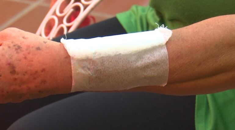 Jubilada baleada en colectivo