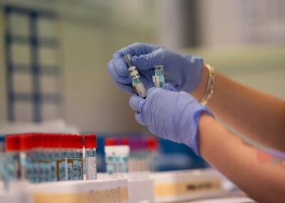 Laboratorio de serología del hospital San Carlos, en Madrid.  La OMS advierte que la dexametasona no previene el covid-19.