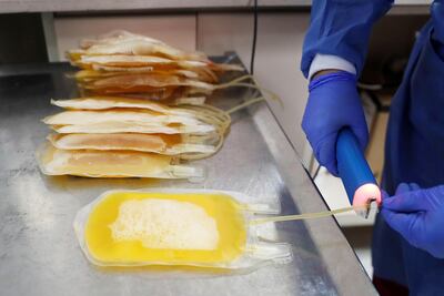 El plasma es extraído de la sangre de los pacientes que superaron el nuevo coronavirus.