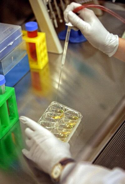 Científicos del Centro Nacional de Investigaciones Oncológicas (CNIO) ha descubierto el “punto débil” que vuelve vulnerables y “multi-resistentes” a algunos tumores frente a muchos fármacos y han diseñado una estrategia potencial para vencerla.