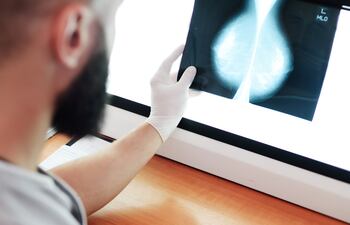 Un nuevo tratamiento de radioterapia contra tumores, que utilizará radiación de electrones a alta energía similares a los que se experimentan en el Centro Europeo de Física de Partículas de Ginebra (CERN), ha sido presentado hoy viernes en el hospital suizo donde comenzará a funcionar hacia 2025.