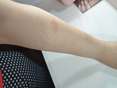 La víctima mostró las señales de violencia en su cuerpo.