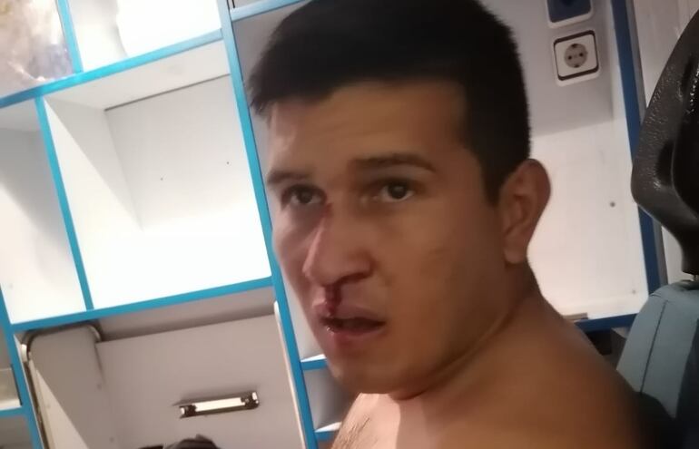El suboficial ayudante Adrián Ramírez, fue herido con en el rostro en los incidentes protagonizados por los hinchas del Club Sportivo Luqueño.