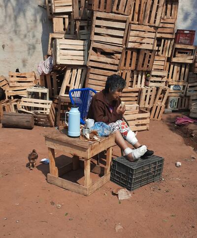 La mujer sufrió algunas quemaduras y además sufre de epilepsia y parálisis.