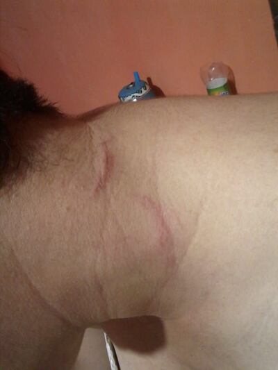 /pf/resources/images/abc-placeholder.png?d=2395