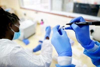 El medicamento antiviral Remdesivir muestra efecto “claro” contra el covid-19, según estudio hecho en Estados Unidos, enfermedad que mató ya al menos a unas 200.000 personas.