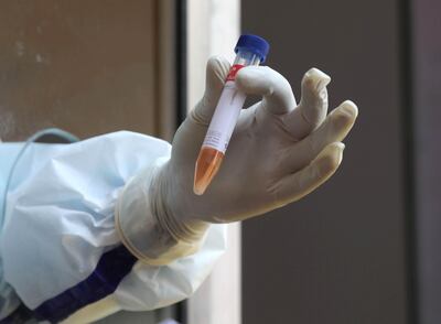 Toma de muestra para análisis.