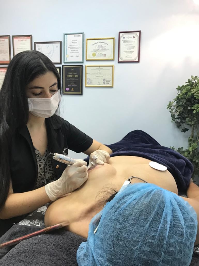 La reconstrucción mamaria a cargo de un cirujano plástico, post mastectomía, concluye con la micropigmentación, que ya se realiza en nuestro país.