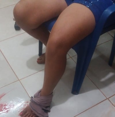 Luciana Cáceres fue baleada por su pareja.