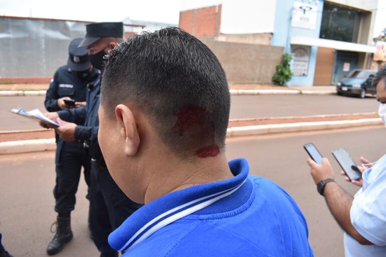 Los asaltantes golpearon al agente policial.