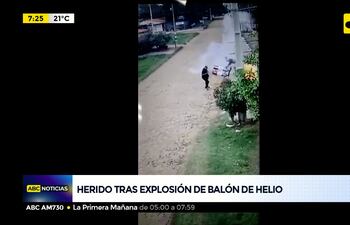 Herido tras exposión de balón de helio