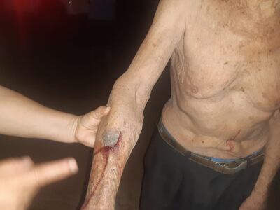 Uno de los golpes recibidos por el adulto mayor.