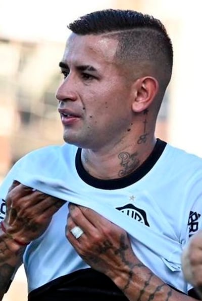 Derlis Alberto González Galeano (20/03/1994) sufrió su segunda lesión de gravedad en su carrera.