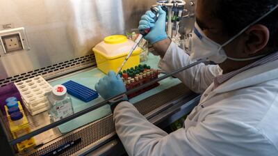 Técnicos de un laboratorio analizan muestras tomadas a pacientes bajo sospecha de tener coronavirus.