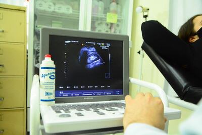 /pf/resources/images/abc-placeholder.png?d=2429