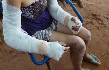 La mujer quedó con múltiples lesiones en todo el cuerpo. Su pareja, el docente Édgar Vera Benítez está acusado de intento de feminicidio.